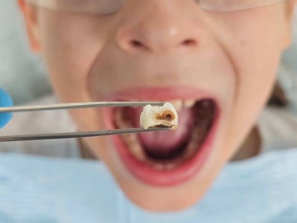 Best Weekend Emergency Dentist in Alexander, AR